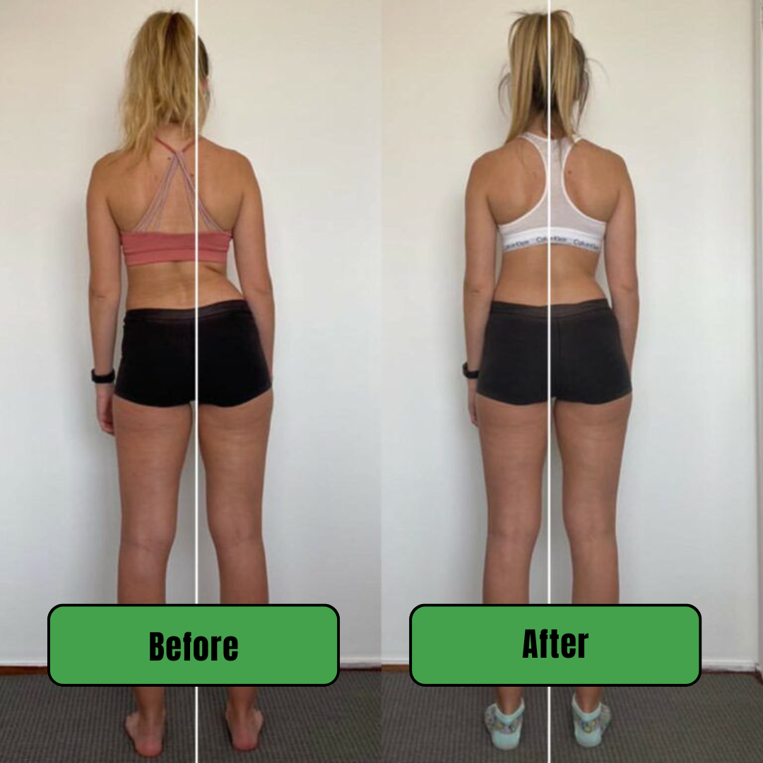 CoreWell™ Posture Corrector